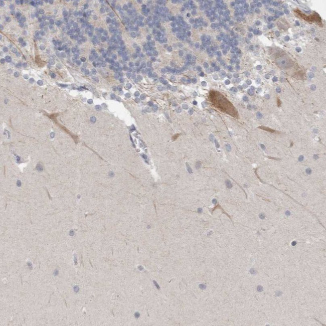 NIPA1 Antibody in Immunohistochemistry (IHC)