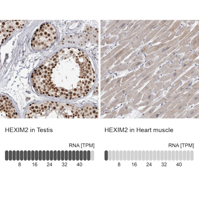 HEXIM2 Antibody in Immunohistochemistry (IHC)
