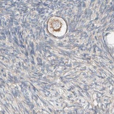 PCM1 Antibody in Immunohistochemistry (IHC)