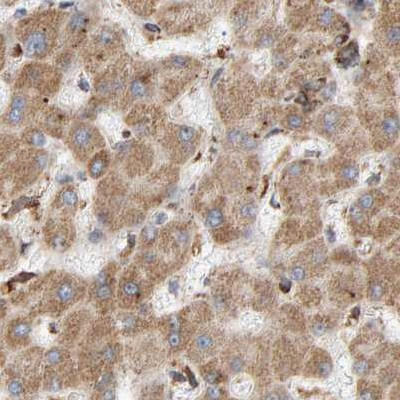 MRPL45 Antibody in Immunohistochemistry (IHC)