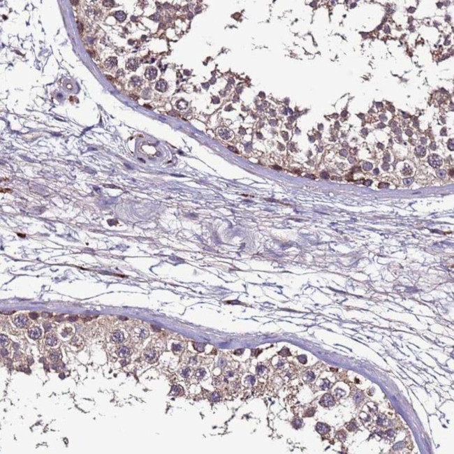 CEP55 Antibody in Immunohistochemistry (IHC)