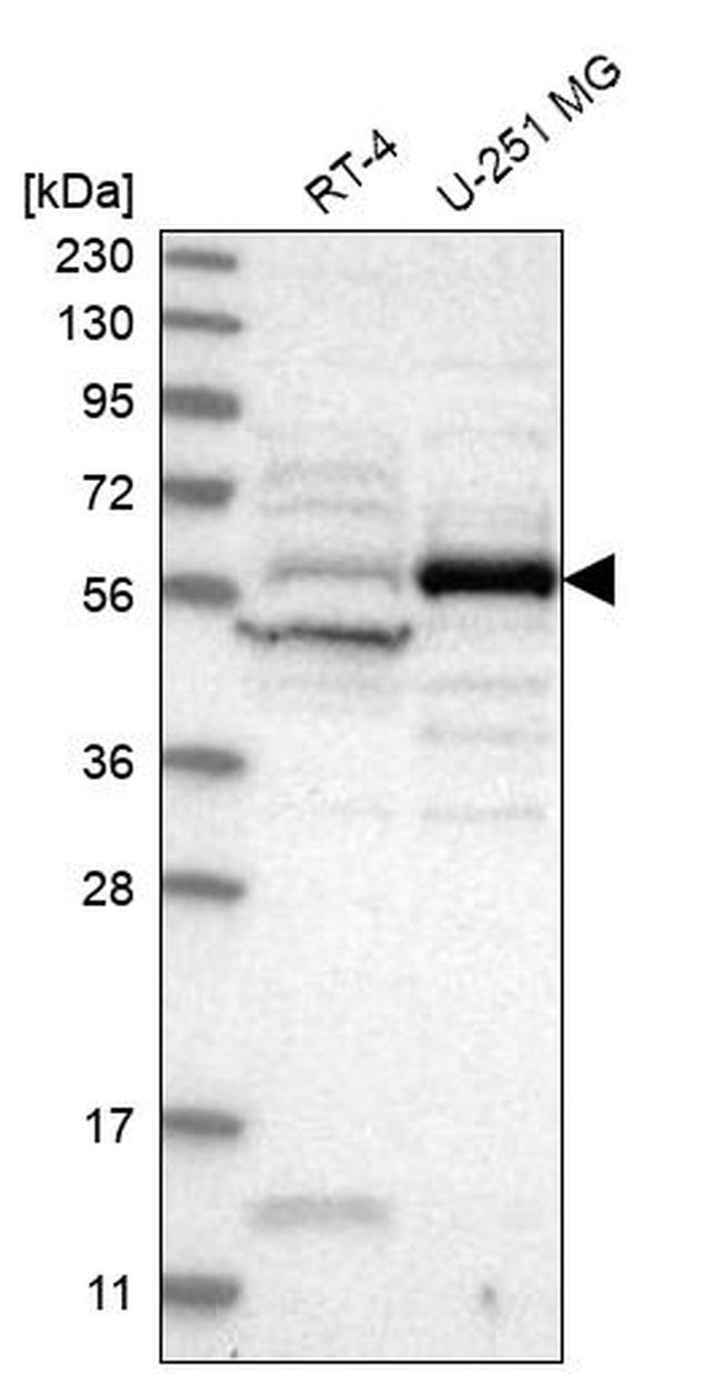 CEP55 Antibody in Western Blot (WB)