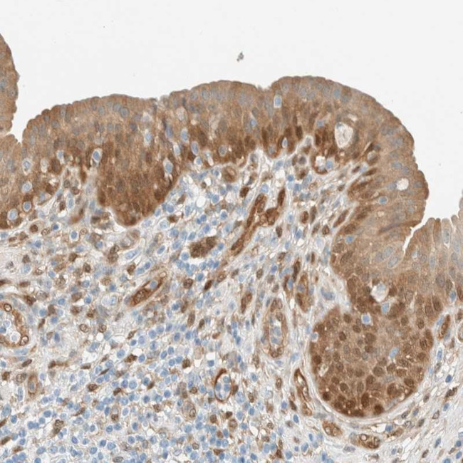 NXN Antibody in Immunohistochemistry (IHC)