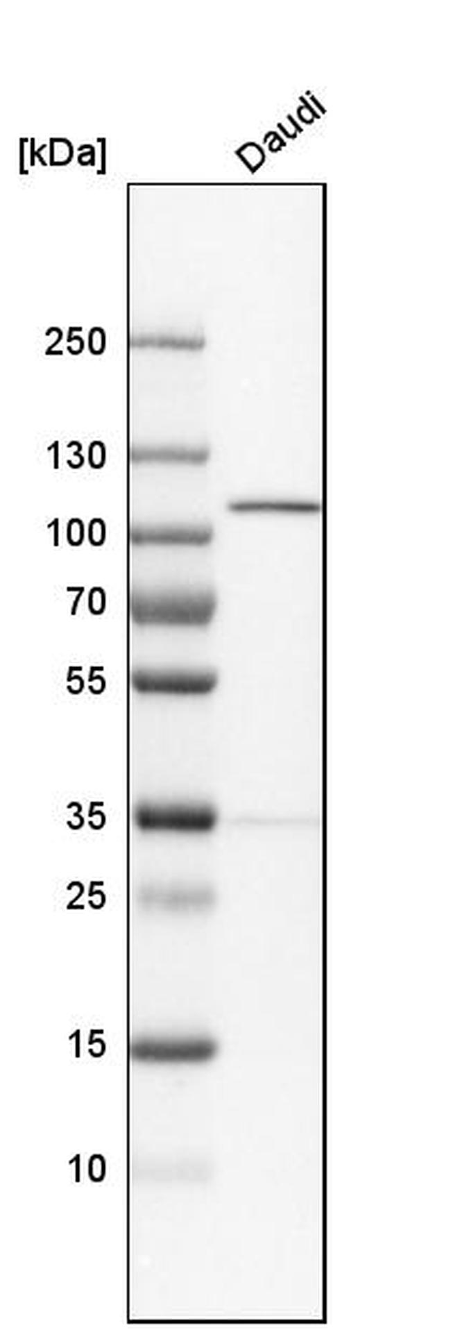 NAA15 Antibody in Western Blot (WB)