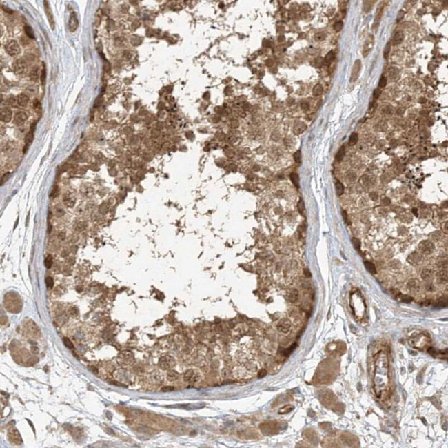 ZNF653 Antibody in Immunohistochemistry (IHC)