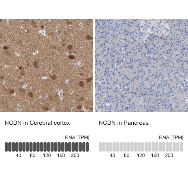 NCDN Antibody in Immunohistochemistry (IHC)