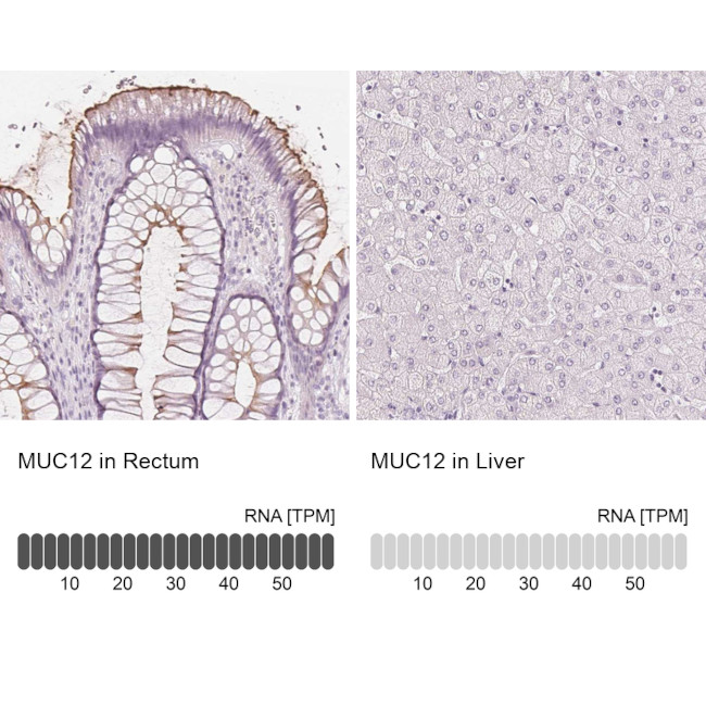 MUC12 Antibody in Immunohistochemistry (IHC)