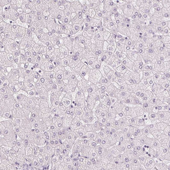 MUC12 Antibody in Immunohistochemistry (IHC)