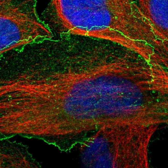 BAIAP2L1 Antibody in Immunocytochemistry (ICC/IF)