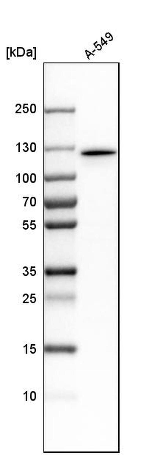MYO1E Antibody in Western Blot (WB)