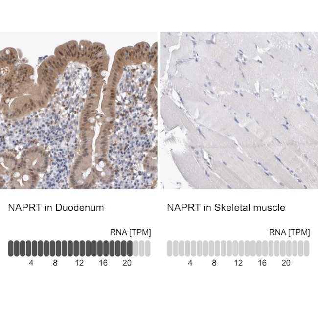 NAPRT1 Antibody in Immunohistochemistry (IHC)