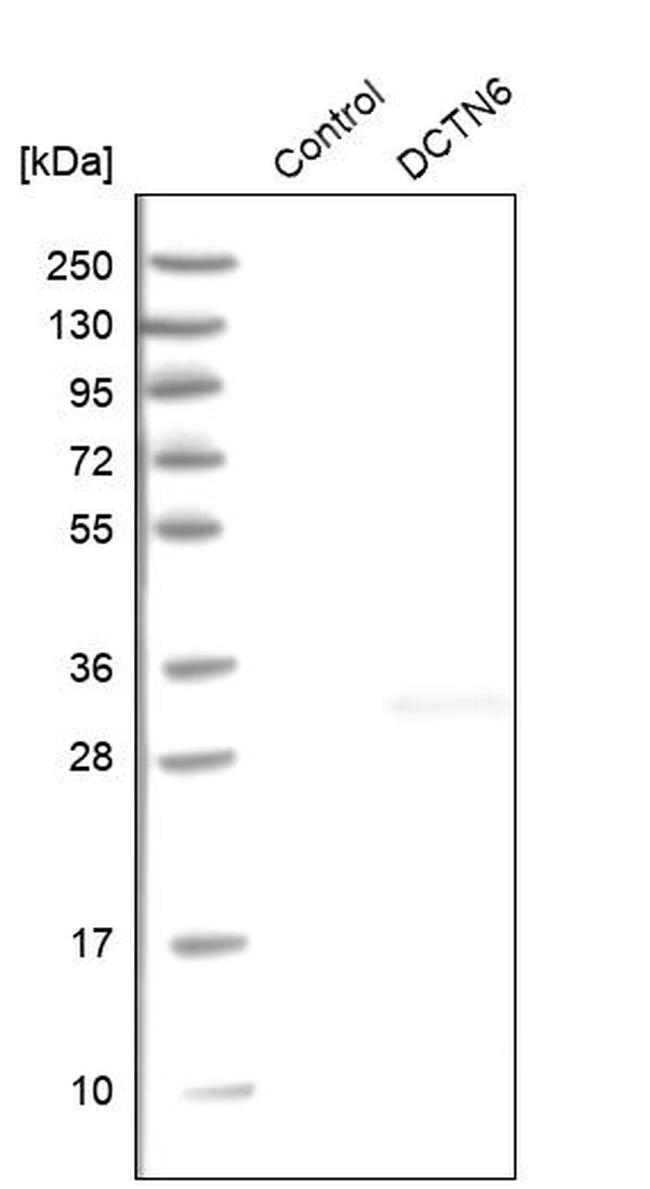 DCTN6 Antibody in Western Blot (WB)