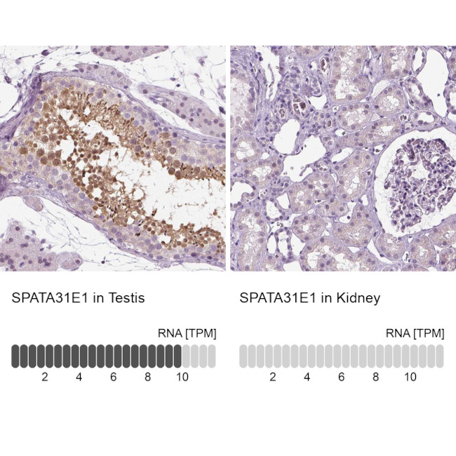 SPATA31E1 Antibody