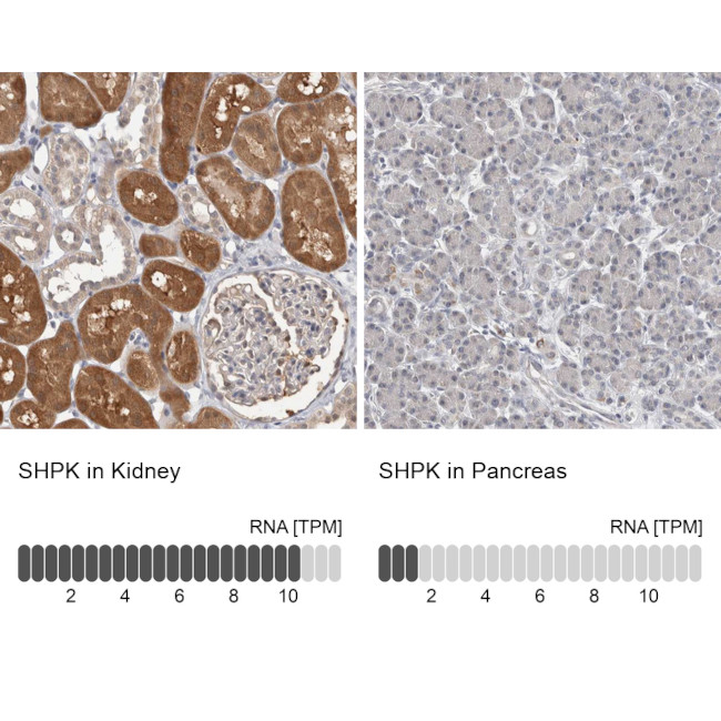 CARKL Antibody in Immunohistochemistry (IHC)