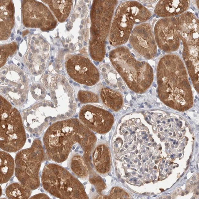 CARKL Antibody in Immunohistochemistry (IHC)