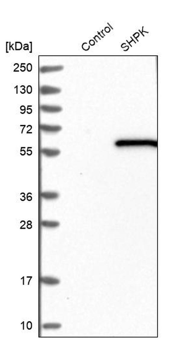 CARKL Antibody in Western Blot (WB)