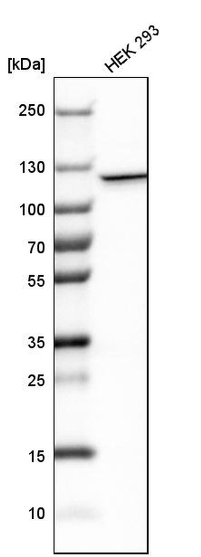 IARS2 Antibody in Western Blot (WB)