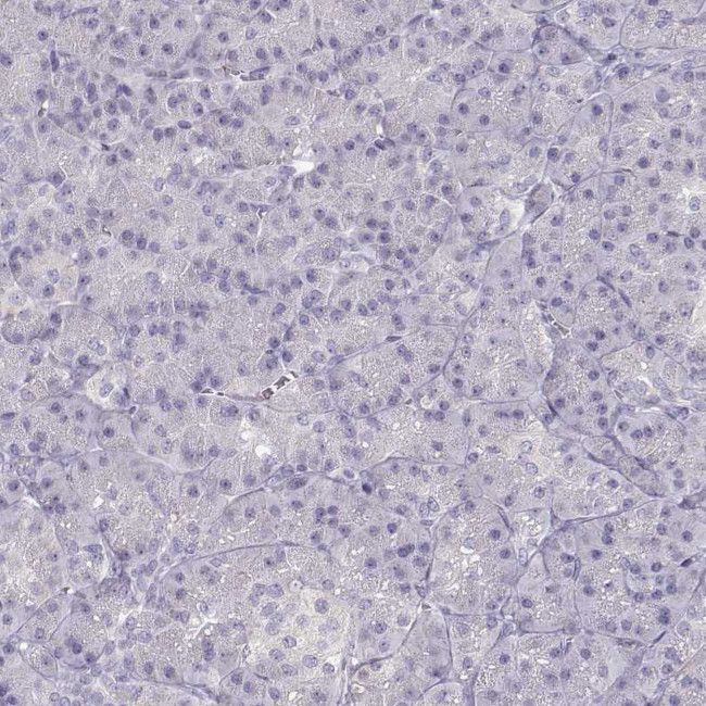 KLF17 Antibody in Immunohistochemistry (IHC)