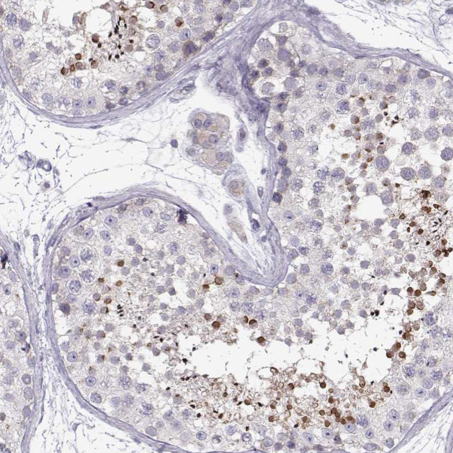 KLF17 Antibody in Immunohistochemistry (IHC)