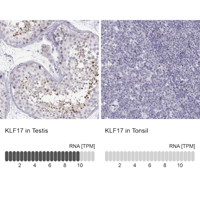 KLF17 Antibody