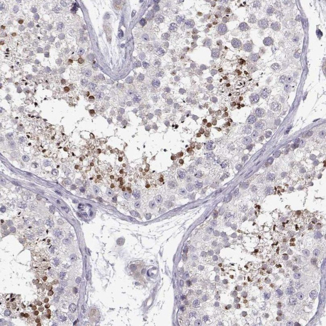 KLF17 Antibody in Immunohistochemistry (IHC)