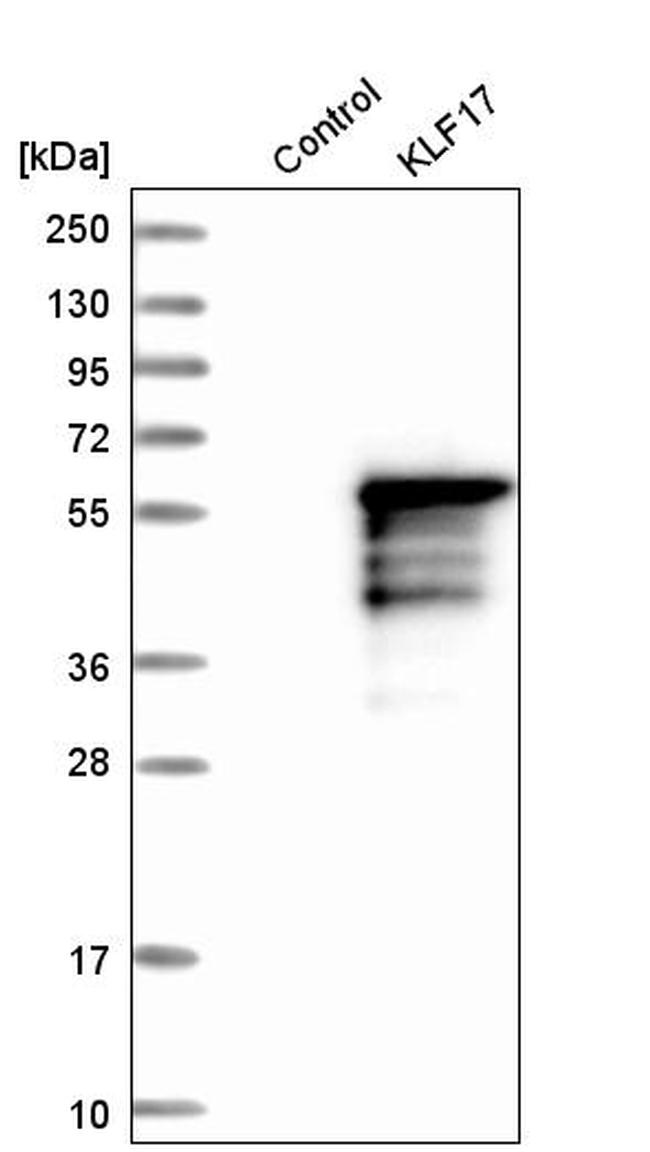 KLF17 Antibody in Western Blot (WB)