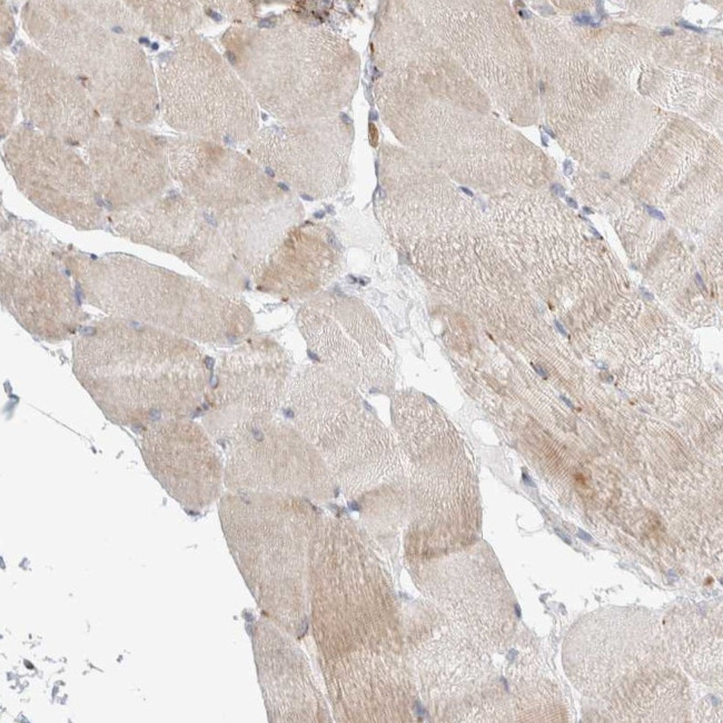 SLC38A10 Antibody in Immunohistochemistry (IHC)