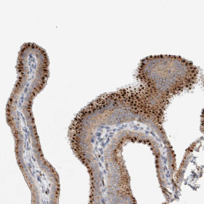 SLC38A10 Antibody in Immunohistochemistry (IHC)