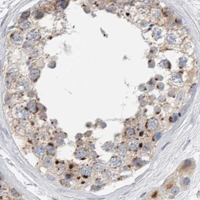 SLC38A10 Antibody in Immunohistochemistry (IHC)