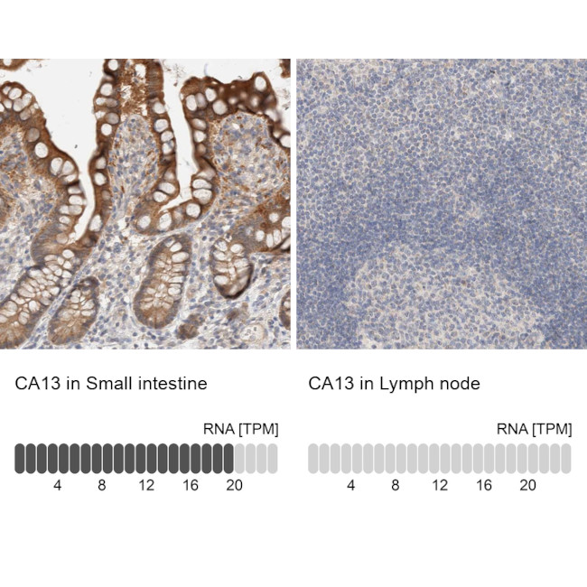 Carbonic Anhydrase XIII Antibody in Immunohistochemistry (IHC)