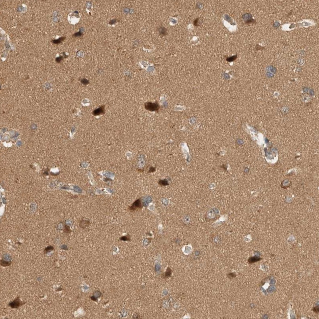 OTUD6B Antibody in Immunohistochemistry (IHC)