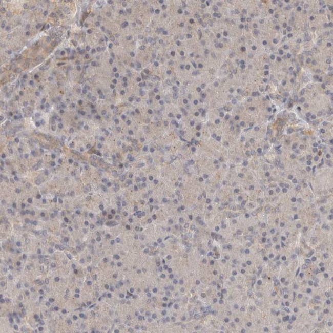 OTUD6B Antibody in Immunohistochemistry (IHC)