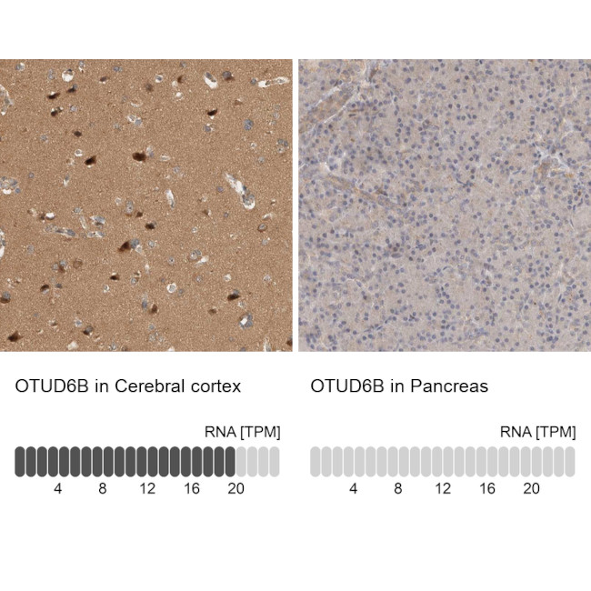 OTUD6B Antibody