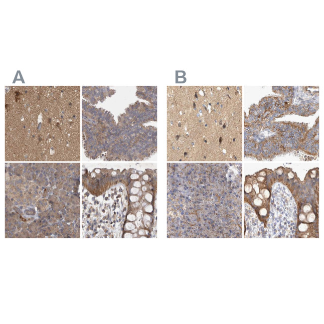 BZRAP1 Antibody in Immunohistochemistry (IHC)