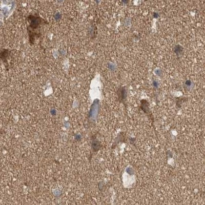 BZRAP1 Antibody in Immunohistochemistry (IHC)