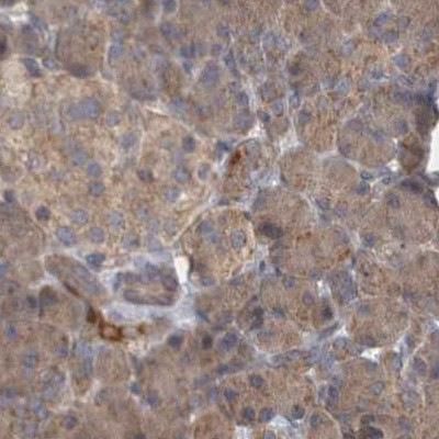 BZRAP1 Antibody in Immunohistochemistry (IHC)