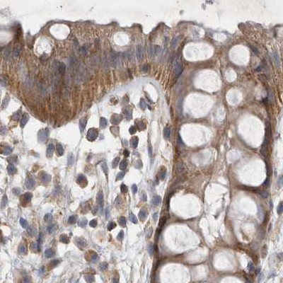 BZRAP1 Antibody in Immunohistochemistry (IHC)