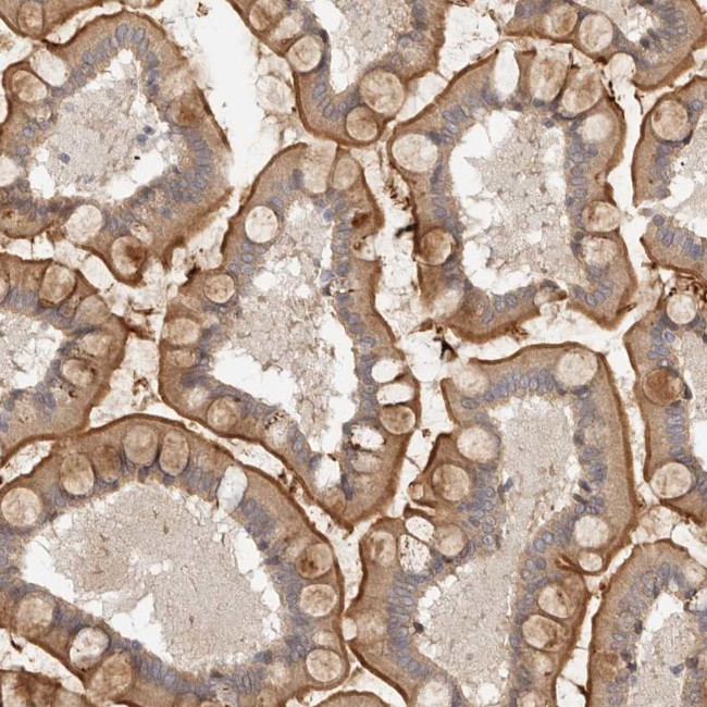 MICALL2 Antibody in Immunohistochemistry (IHC)