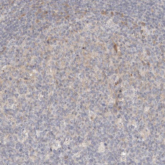 MICALL2 Antibody in Immunohistochemistry (IHC)