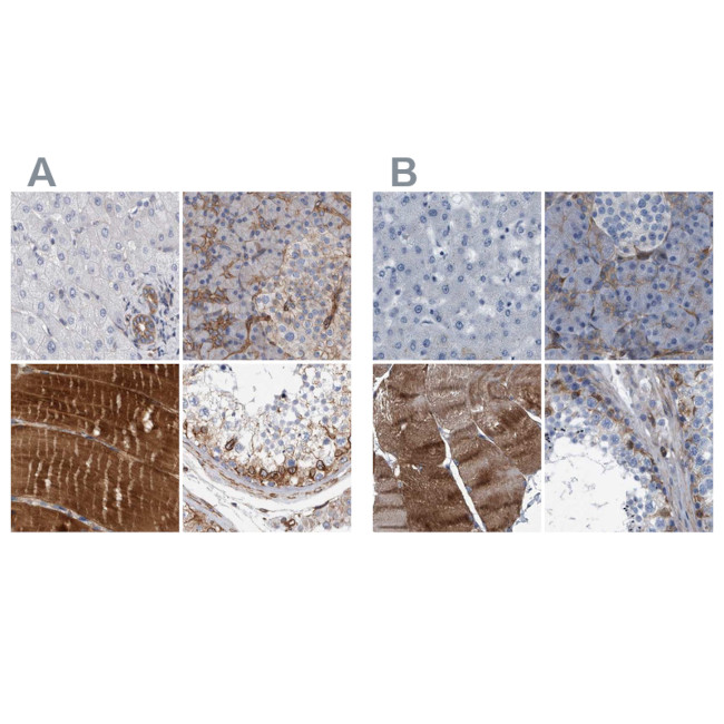 Plectin Antibody in Immunohistochemistry (IHC)