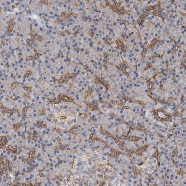 Plectin Antibody in Immunohistochemistry (IHC)