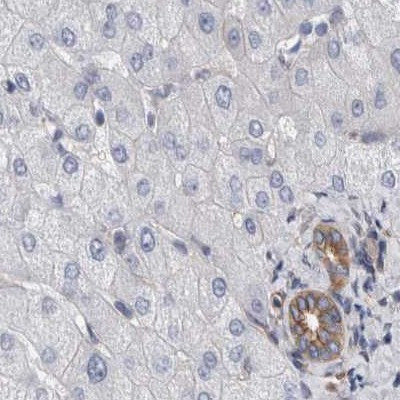 Plectin Antibody in Immunohistochemistry (IHC)