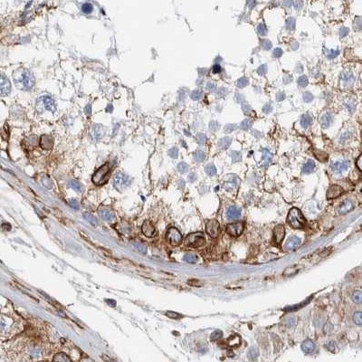 Plectin Antibody in Immunohistochemistry (IHC)