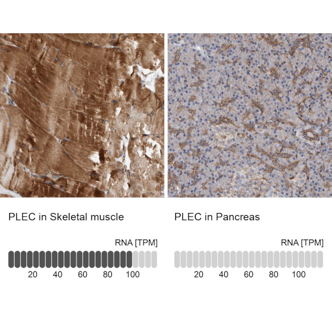 Plectin Antibody