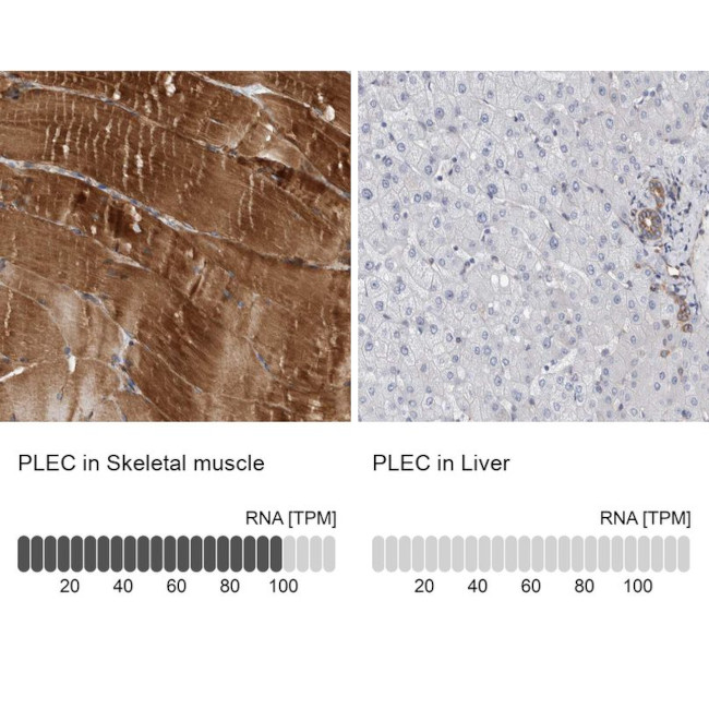 Plectin Antibody