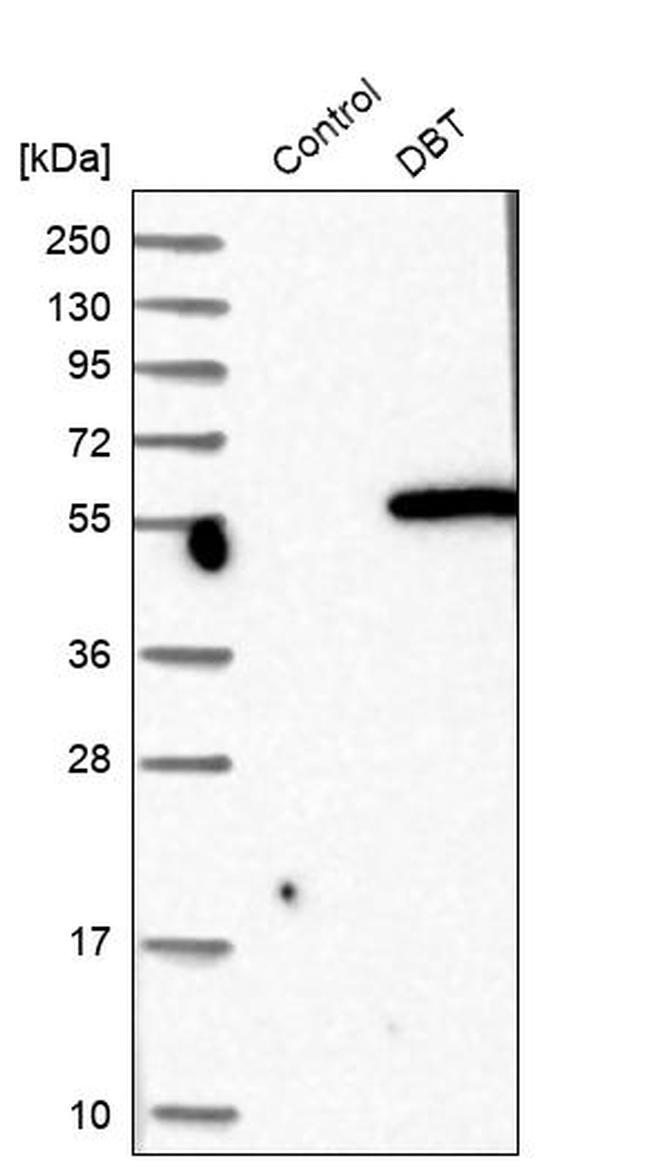 DBT Antibody in Western Blot (WB)