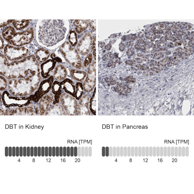 DBT Antibody in Immunohistochemistry (IHC)