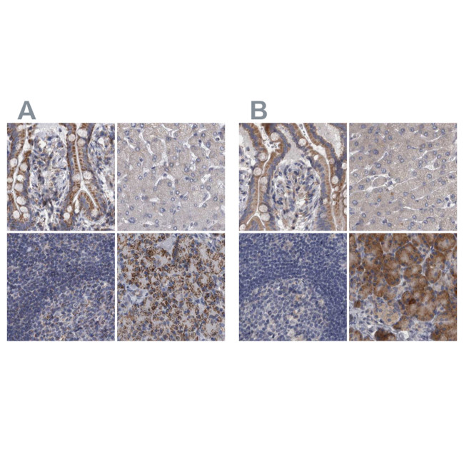 DBT Antibody in Immunohistochemistry (IHC)