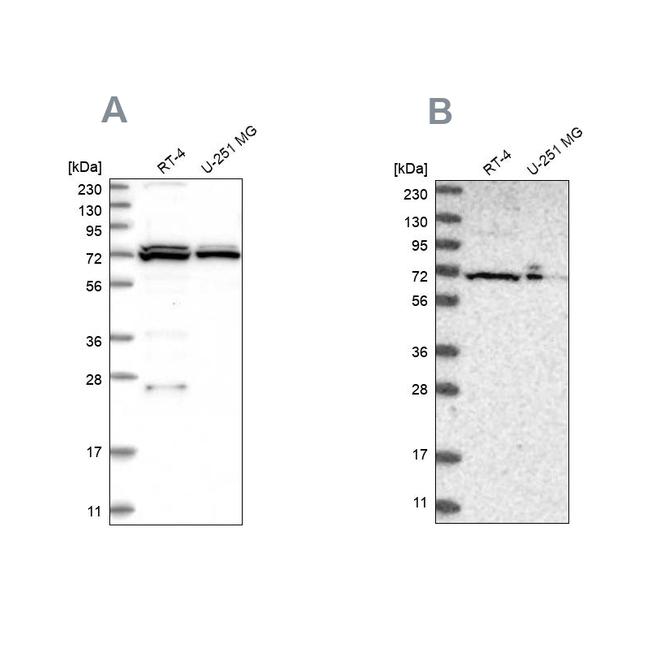 AspRS Antibody in Western Blot (WB)