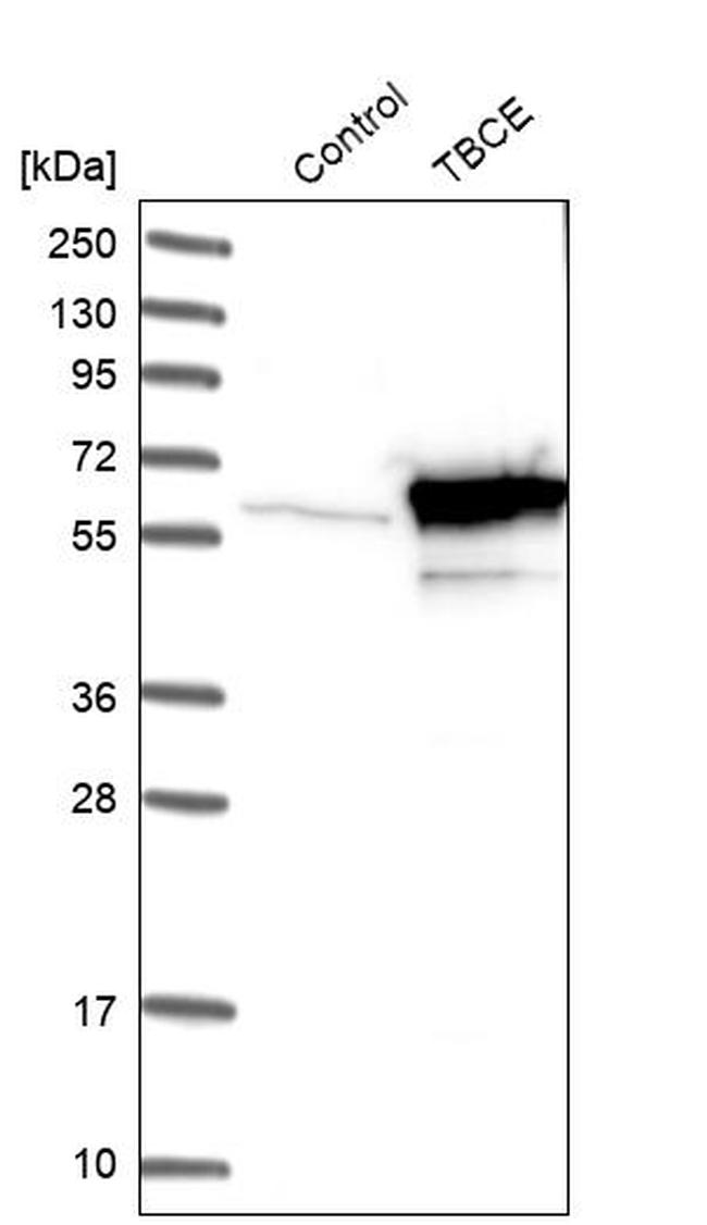 TBCE Antibody in Western Blot (WB)